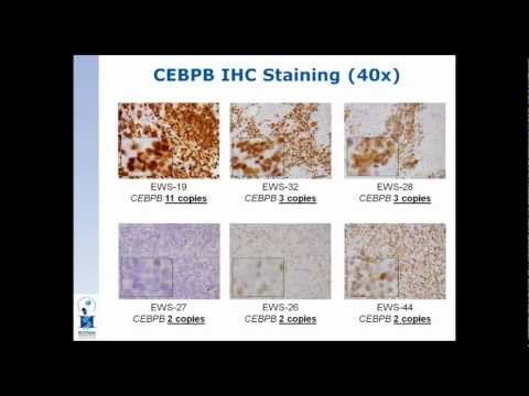 Effective Utilization of FFPE Samples to Enable Cancer Discovery