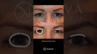 Nava Face & Eye