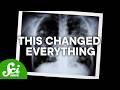 The Tragedy Of The Cystic Fibrosis Cure