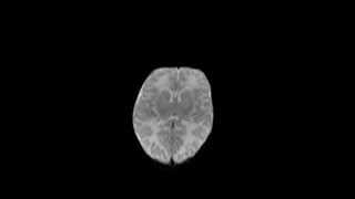 Case of the Day - 22 Nov 24