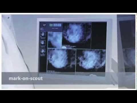 GiottoUSA MammoBiopsy