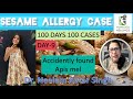 100 DAYS 100 CASES DAY 9 SESAME ALLERGY CASE DR NEELAM AVTAR SINGH Video 181