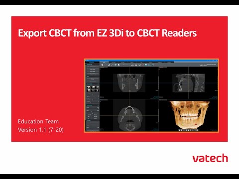 Export and Upload to CBCT Readers