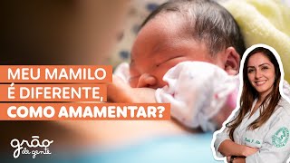 MEU MAMILO É PARA DENTRO, COMO AMAMENTAR? | TIPOS DE MAMILO 🤱🏻