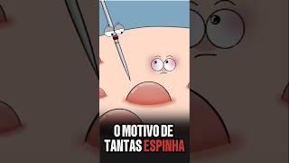 POQUE SAI TANTAS ESPINHA NO ROSTO