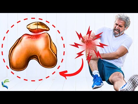 Top 5 ejercicios ▶️ para tratar la CONDROMALACIA ROTULIANA ✅