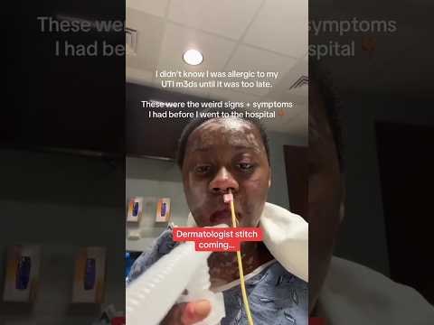 This Rare Condition Can Be Caused by Common Medicines