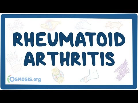 , title : 'Rheumatoid arthritis - causes, symptoms, diagnosis, treatment, pathology'