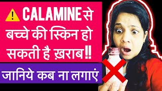 बच्चे को कैलामाइन लगाना हो सकता है खतरनाक !!! 😱 सच्चाई जानकर दंग रह जाएँगे !