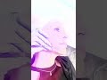 Full Face Filler Transformation