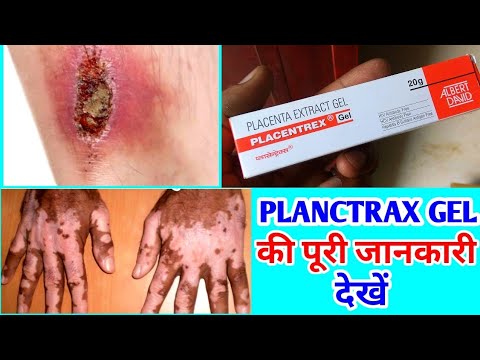 Placentrex V Gel 20gm, TUBE