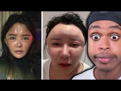 The Deadly Chinese Bubble Face Trend