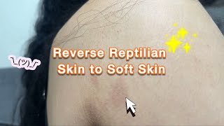 Reverse Reptilian Skin to Soft Skin | Curly Cami Channel 