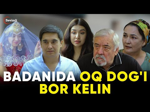 BADANIDA OQ DOG'I BOR KELIN - TUGUN 239 BO'LIM