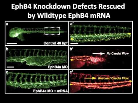 RASA1 mutations in vascular malformations