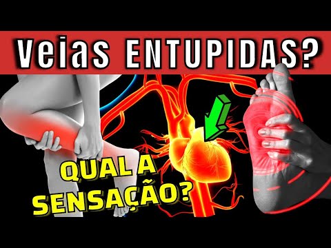 CLOGGED VEIN, HOW DOES IT FEEL? How to combat lack of circulation in the legs, feet and heart