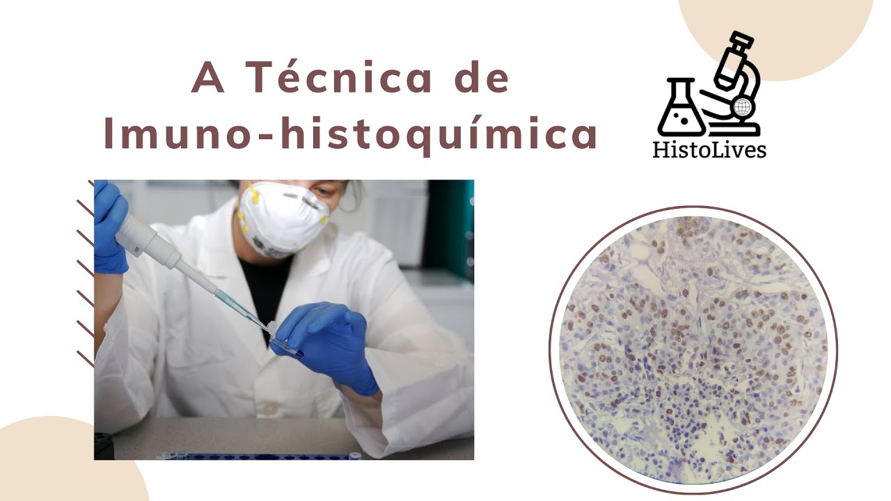 Imuno-histoquímica como realizá-la?