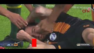 Ryan Mason Suffers horrific head injury
