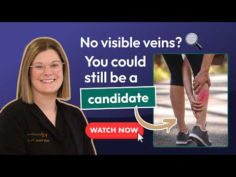 Varicose Veins Aren’t Always Visible — Here’s What You Should Know