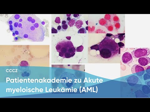 CCCZ Patientenakademie zu Akute myeloische Leukämie (AML)