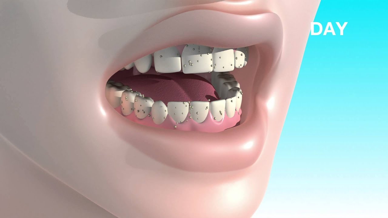 Nite & Day // Teeth Whitening System (Green Apple) video thumbnail