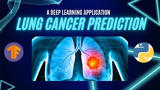 Download the video "Lung Cancer Prediction with CNNs & TensorFlow: A Deep Learning Application"