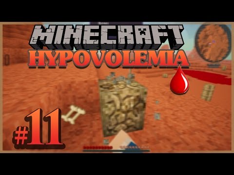 HYPOVOLEMIA FR ep 11 : MINECRAFT MODPACK [FR] Francais