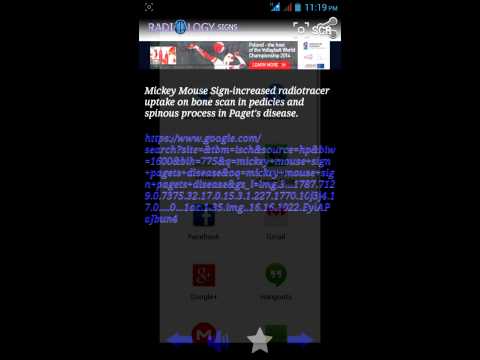 Radiology Signs Video