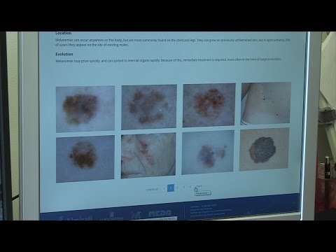 VK100: Hudcancerfall fördubblade - så upptäcker du den