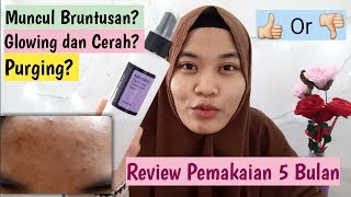Download lagu Review COSRX AHA/BHA CLARIFYING TREATMEN TONER | Hasil Selama 5 Bulan By Siti Alifah Faiz mp3 Download lagu Review COSRX AHA/BHA CLARIFYING TREATMEN TONER | Hasil Selama 5 Bulan By Siti Alifah Faiz mp3