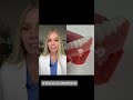 What to do if your denture doesn’t fit. #denture #implant #dentalimplant #dentist