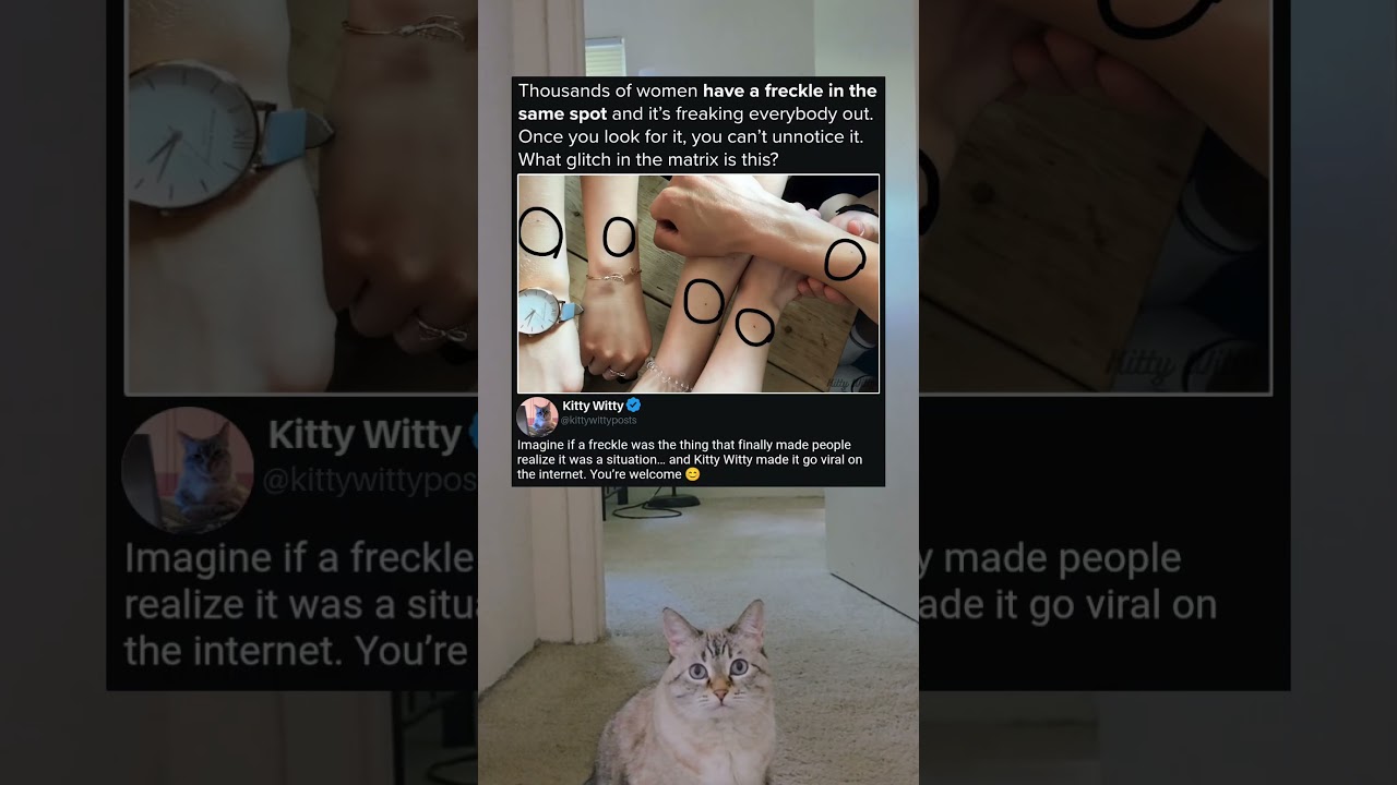 Why Do We All Have This Freckle