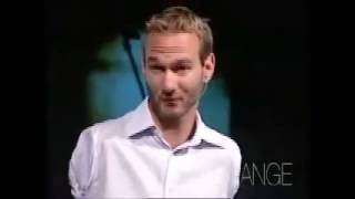 Why Won't God Heal The Amputees?