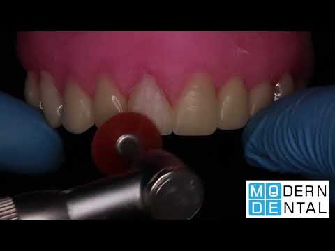 მერილენდის ხიდი-Meryland Bridge - Modern Dental 24/7