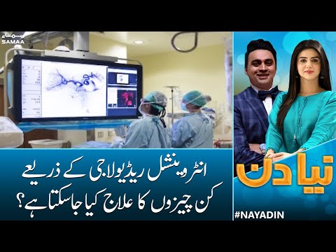What is Interventional Radiology? | Modern Treatment | Naya Din | Samaa News