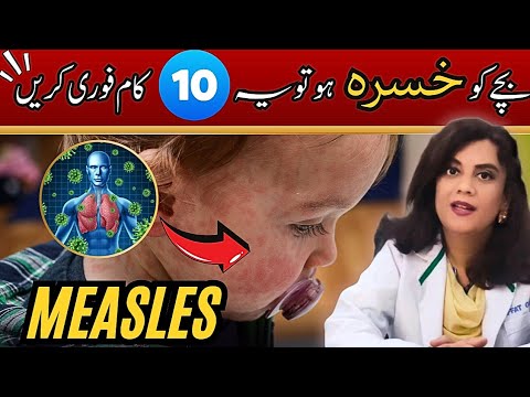 Measles is Coming - What Parents NEED to Know|Dr.Riffat Omer