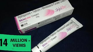 Skin Lite Cream Review Hindi