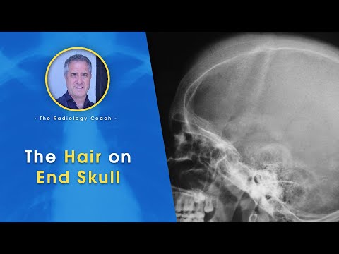 Are My X RAYS in DICOM Format