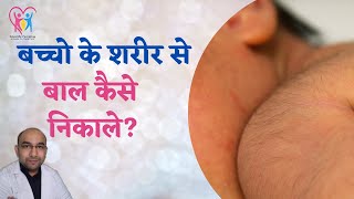 How to remove baby body hair| remove face hair in baby| Home remedies to remove baby facial hair