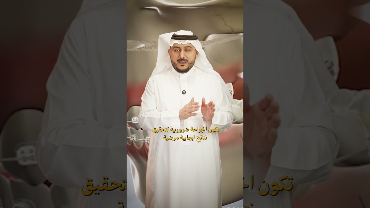 محتوى UGC