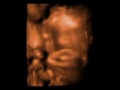 3 D Ultraschall Baby TV