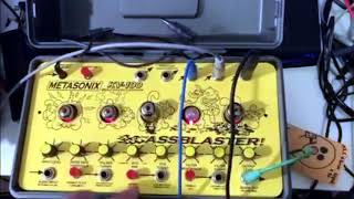 Video thumbnail for Metasonix KV 100 ASSBLASTER w MOOG DFAM & T Rex Tape Echo by Ritchie DeCarlo