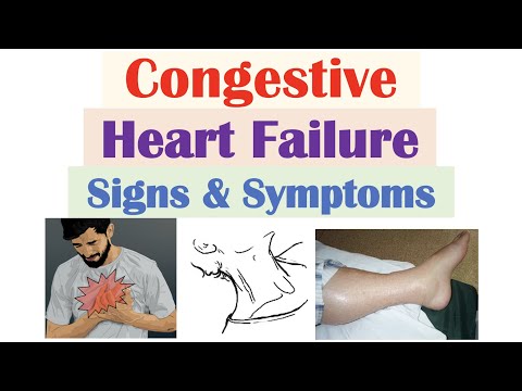 Congestive Heart Failure Signs & Symptoms (& Why They Occur)