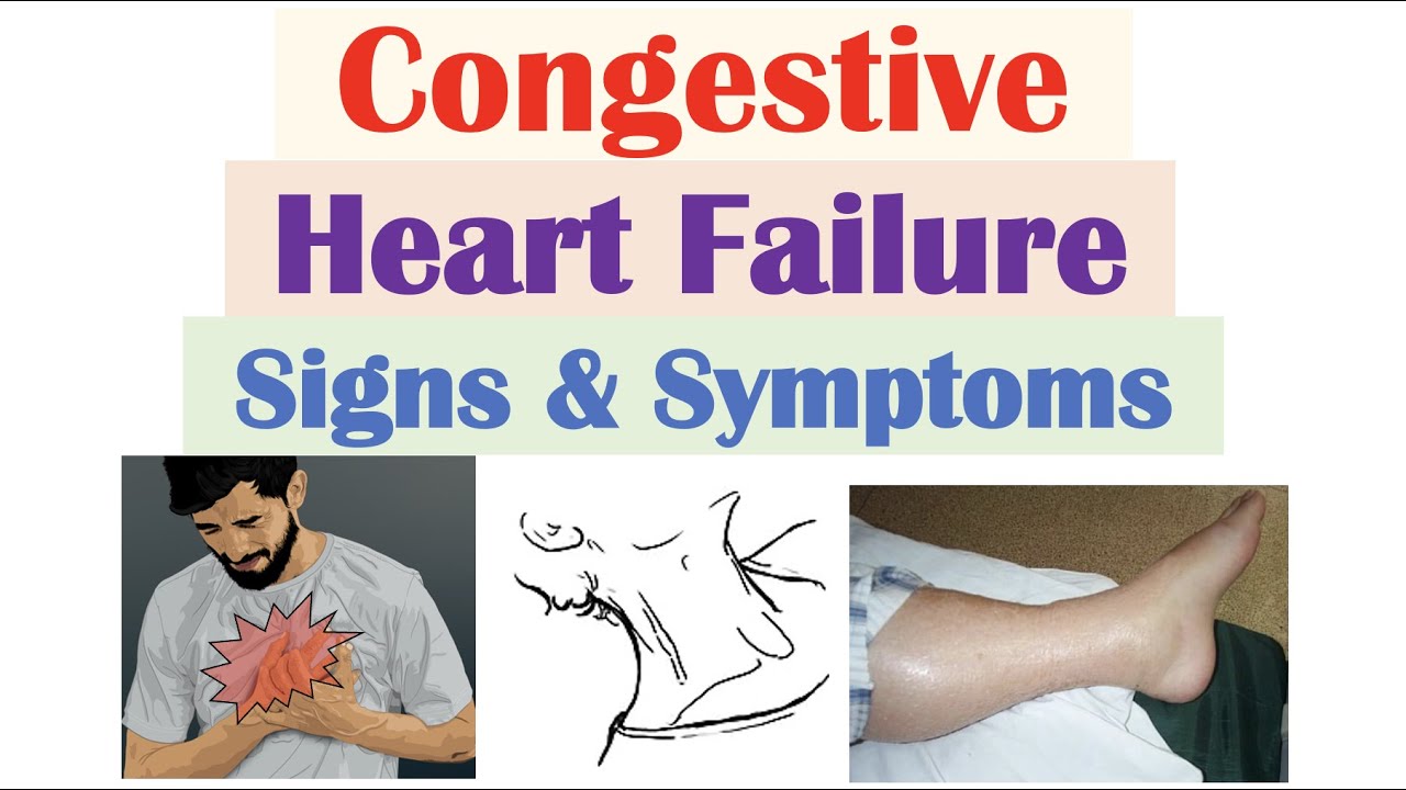 How does a doctor diagnose congestive heart failure?
