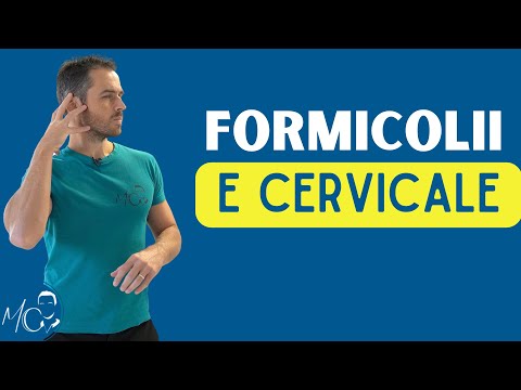 Quando la "cervicale" provoca FORMICOLII: ecco i sintomi ed i rimedi