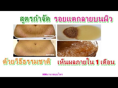 Pisi และหน้าอกเล็ก เต้านมมีขนาดเล็ก