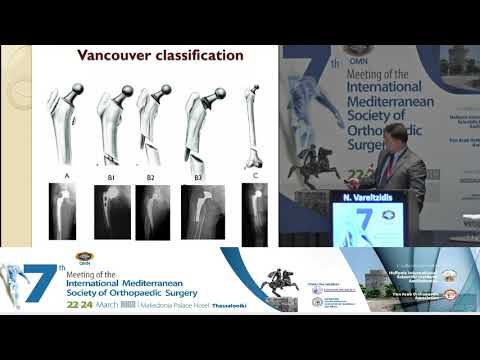 N Vareltzidis - Periprosthetic hip fractures