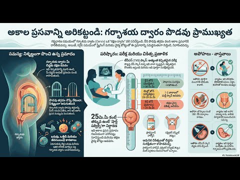 Cervical Length Screening — video thumbnail