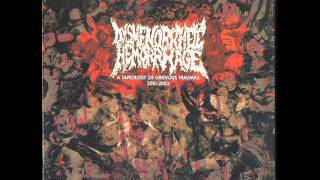 DYSMENORRHEIC HEMORRHAGE - From enslavement to obliteration (NAPALM DEATH cover)