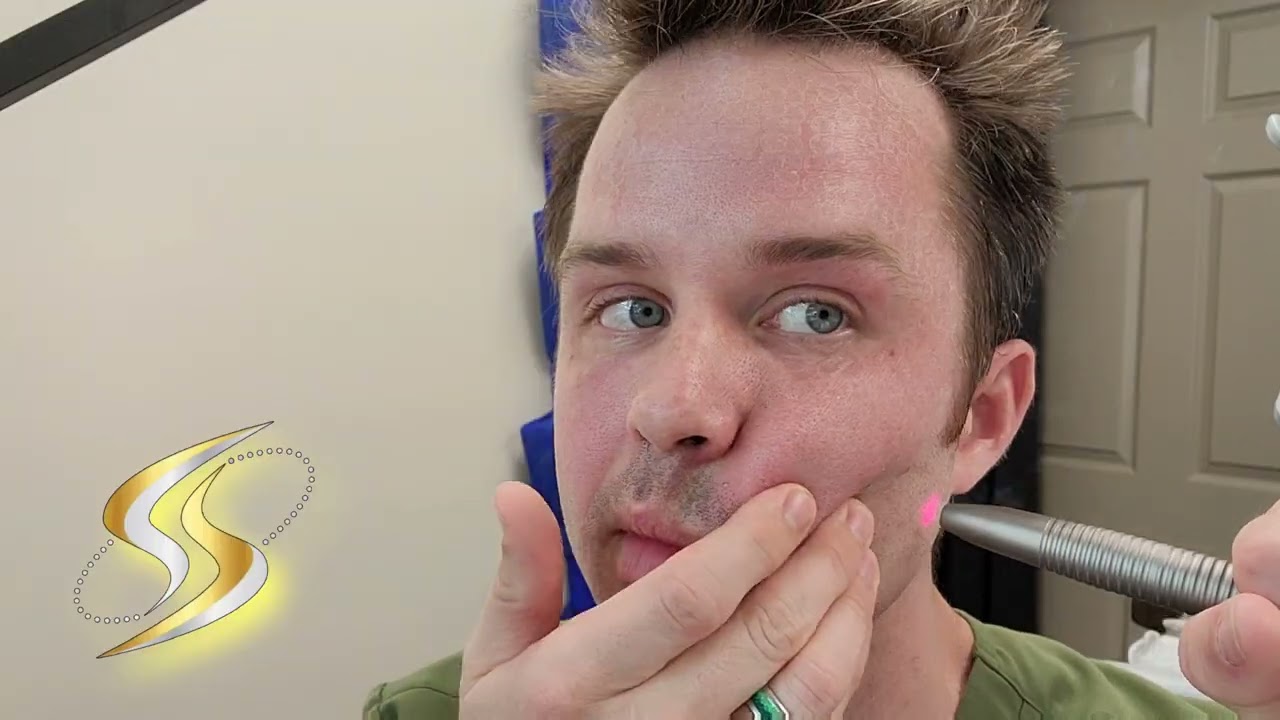 Fotona 4D Face-Lift Laser treatment in Indianapolis